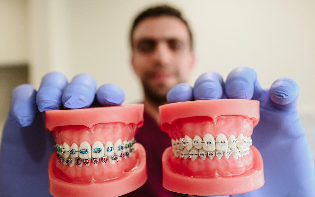 Orthodontic Treatment