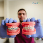 Orthodontic Treatment