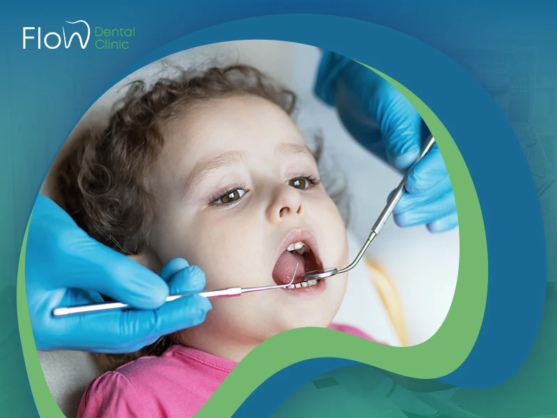 علاج تسوس أسنان الرضع