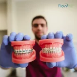 تقويم الأسنان