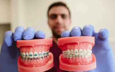 تقويم الأسنان