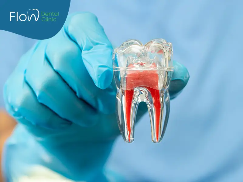 علاج الجذور للأسنان