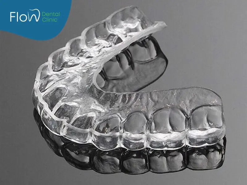 التقويم الشفاف المتحرك