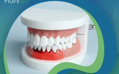 تعرف إلى أعراض التهابات اللثة وعلاجها