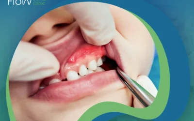 علاج التهاب اللثة للأطفال