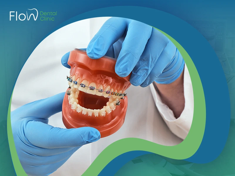 دكتور تقويم اسنان