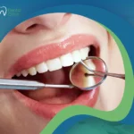 الحشوات التجميلية لسد الفراغات