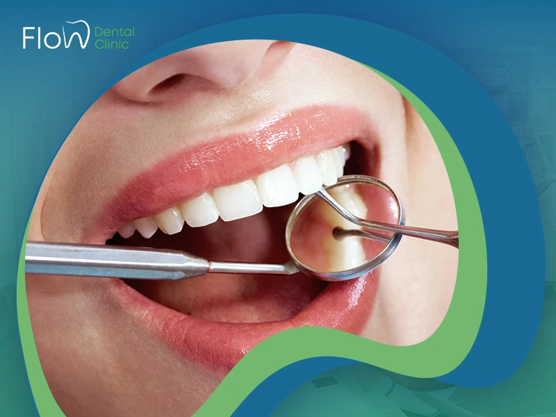 الحشوات التجميلية لسد الفراغات
