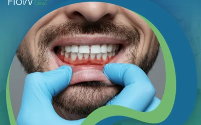 علاج التهاب الاسنان واللثة