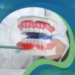 علاج جيوب اللثة