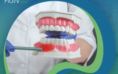 علاج جيوب اللثة