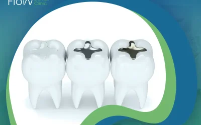 تعرف إلى أنواع الحشوات التجميلية للأسنان