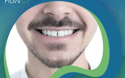 أفضل وسائل علاج فراغات الأسنان