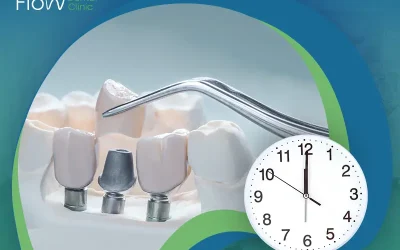 مدة زراعة الأسنان بعد الخلع| التوقيت المناسب