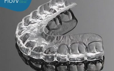 Inhouse Aligners