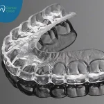 التقويم الشفاف المتحرك