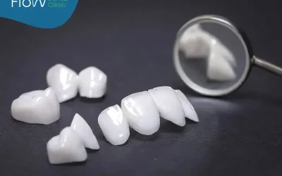 تركيب التاج للاسنان