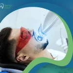التبييض الضوئي للأسنان خيارك المثالي بلا شك