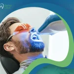 تبييض الأسنان بالليزر: دليل شامل لابتسامة أكثر إشراقًا