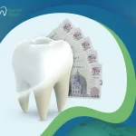 العوامل المؤثرة في سعر تبييض الأسنان في مصر