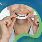 هوليود سمايل المتحركة… الخيار الأمثل لمنحك ابتسامة جذابة