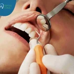 علاج أمراض اللثة