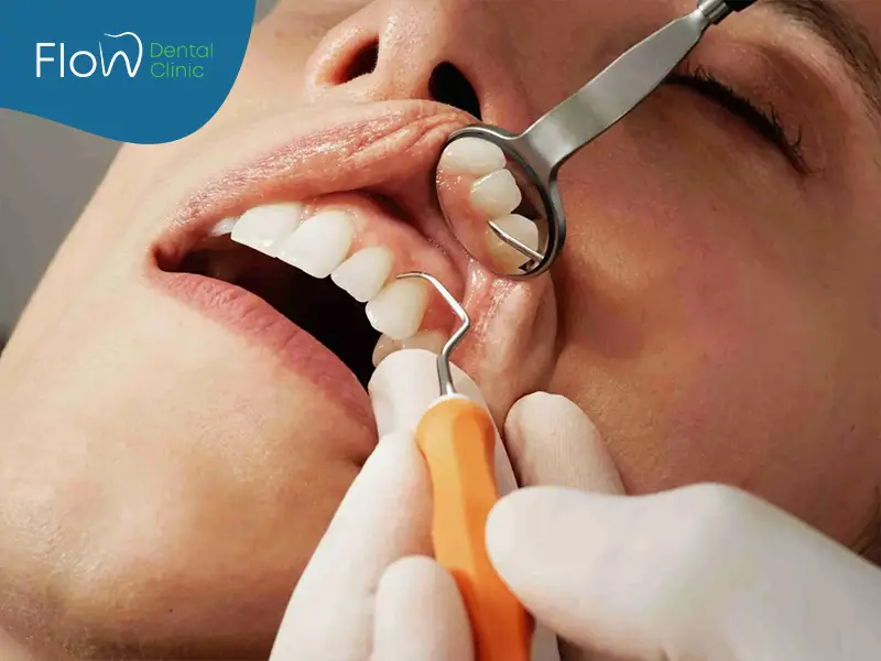 علاج أمراض اللثة