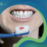 لا تُهمل أسباب التهاب اللثة حتى لا تفقد أسنانك!