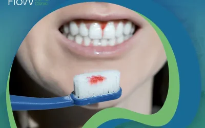 لا تُهمل أسباب التهاب اللثة حتى لا تفقد أسنانك!