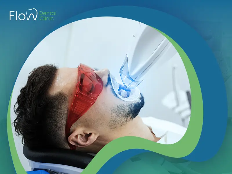 التبييض الضوئي للأسنان خيارك المثالي بلا شك