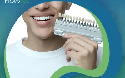 كيف ستكون تجربتي مع الفينير؟