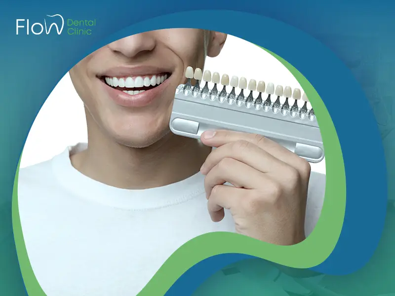 تجربتي مع الفينير