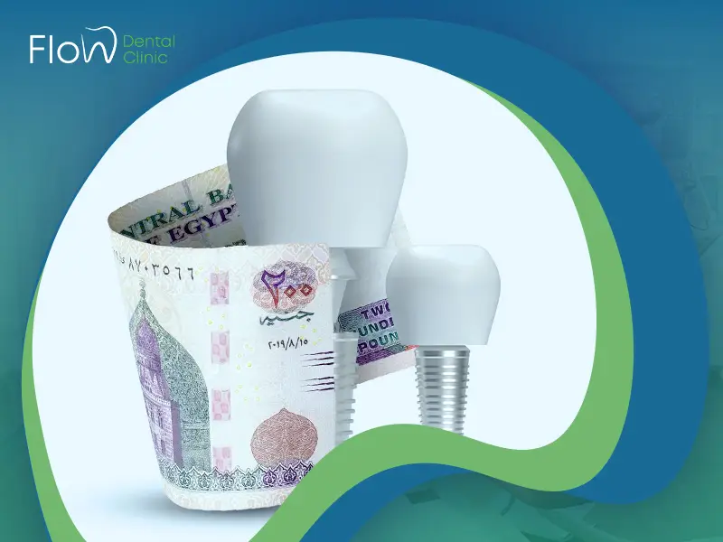 تكلفة زراعة الأسنان في مصر