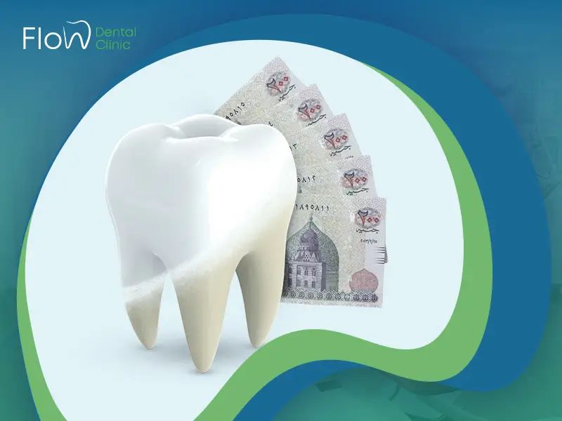 العوامل المؤثرة في سعر تبييض الأسنان في مصر