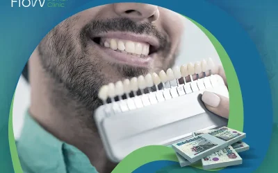 هل سعر فينير الأسنان في متناول الجميع؟
