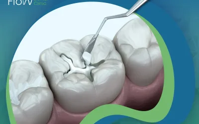 عيوب الحشو التجميلي: لن تؤثر بقوة في قرارك