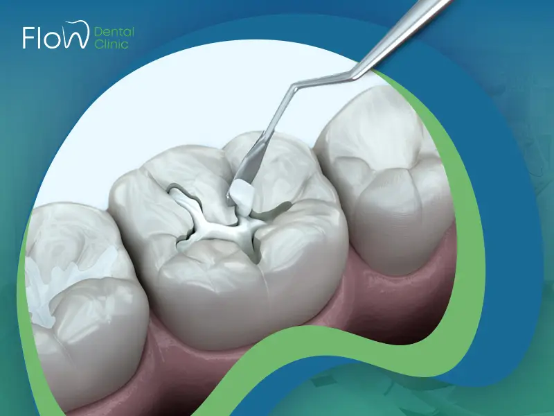 عيوب الحشو التجميلي