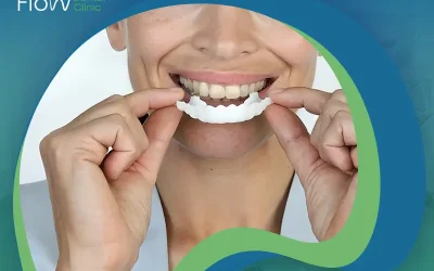 هوليود سمايل المتحركة .. ما هي؟ المميزات والعيوب وطريقة الاستخدام