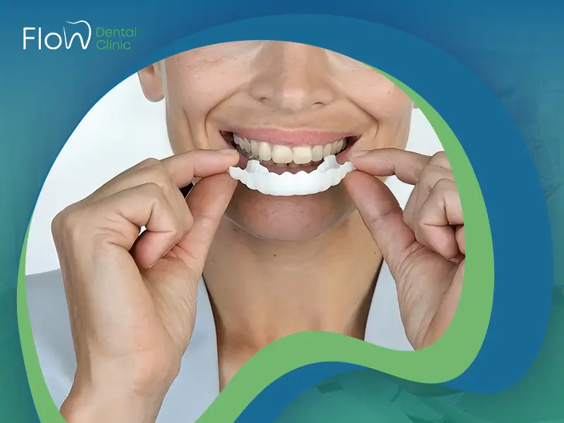 هوليود سمايل المتحركة .. ما هي؟ المميزات والعيوب وطريقة الاستخدام