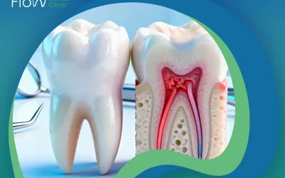 الفرق بين الحشو العادي وحشو العصب