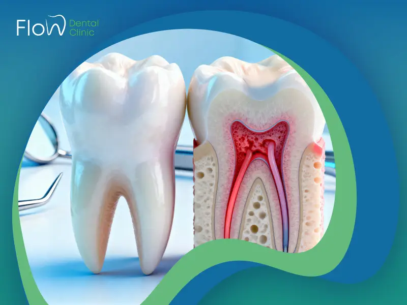 الفرق بين الحشو العادي وحشو العصب