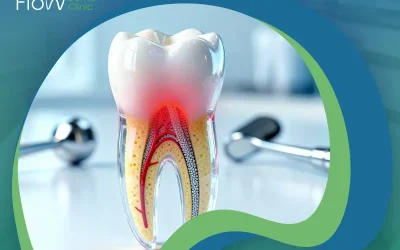 علاج التهاب الضرس بعد حشو العصب