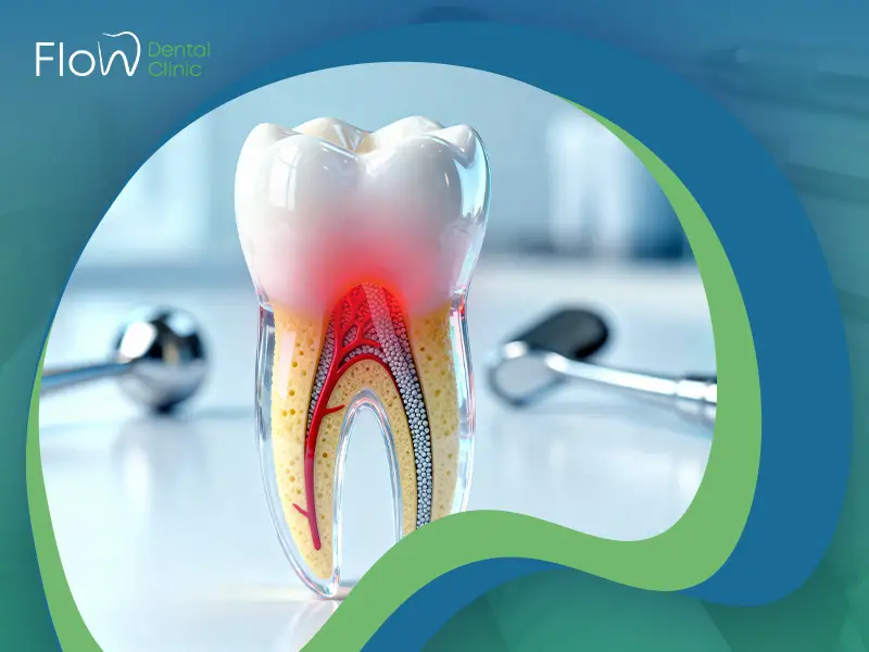 علاج التهاب الضرس بعد حشو العصب