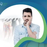 هل حشو العصب مؤلم؟