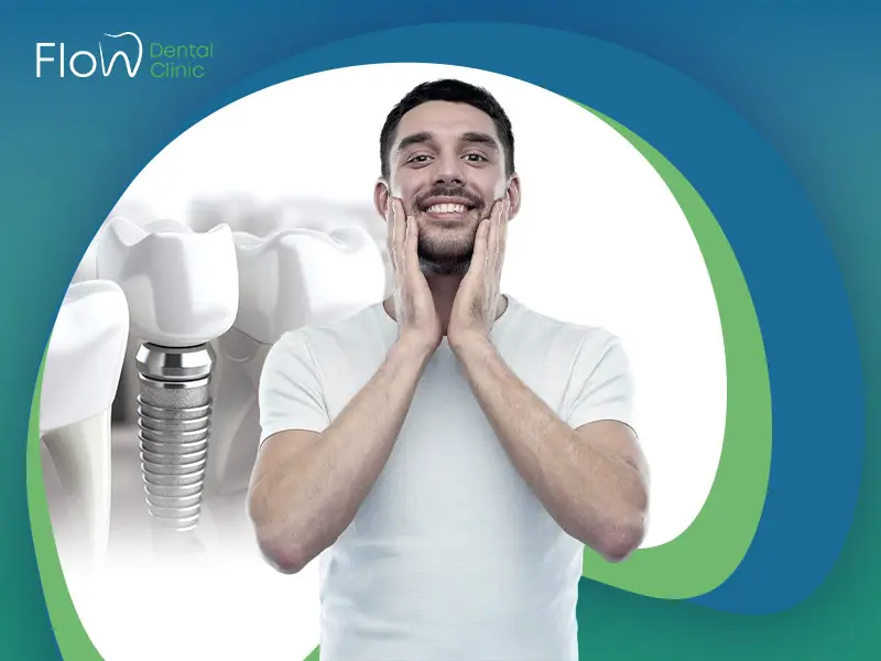 تجربتي مع زراعة الأسنان