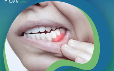 دليلك الشامل حول أساليب علاج نزيف اللثة