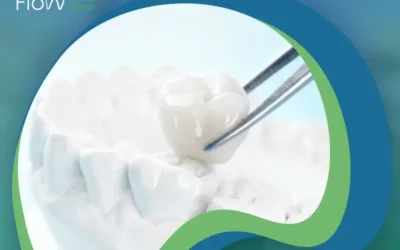 أفضل أنواع الطربوش للأسنان: أيها يناسبك أكثر؟