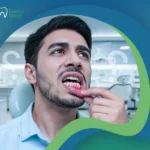 أسباب نزيف اللثة لدى الكبار والأطفال