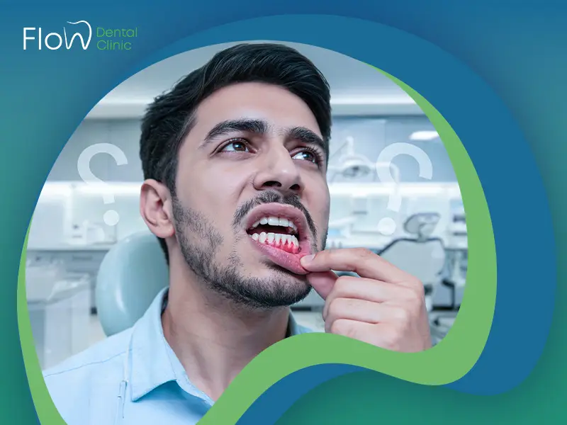 أسباب نزيف اللثة