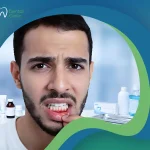ما وسائل علاج تورم اللثة؟